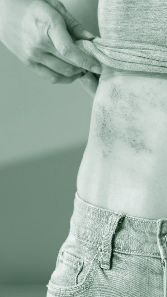 Trusted Medical Dermatology. For All Ages.