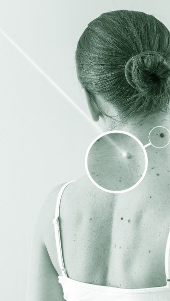 Benign to Expert Skin Care