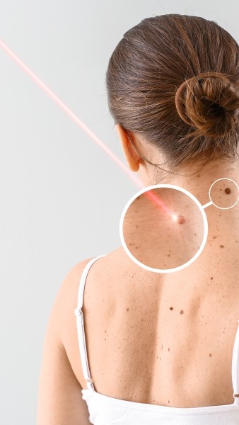 Benign to Expert Skin Care