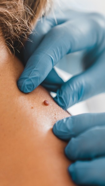 Redefine Beauty with Aesthetic Plastic Surgery